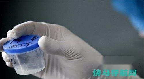 怎么知道精液异常 怎样自我判断精液异常 第3张