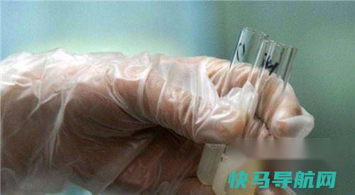 怎么知道精液异常 怎样自我判断精液异常 第5张